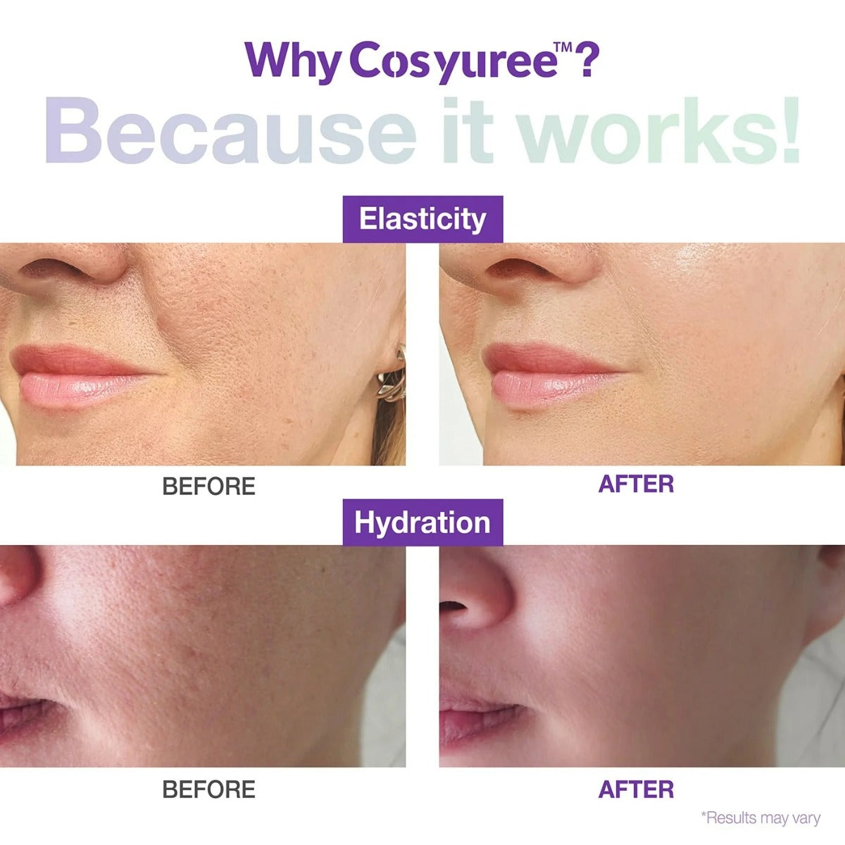 Collagen Spicule Serum [120,000]