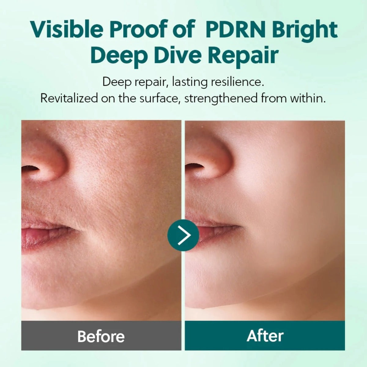 PDRN + Panthenol Booster Serum