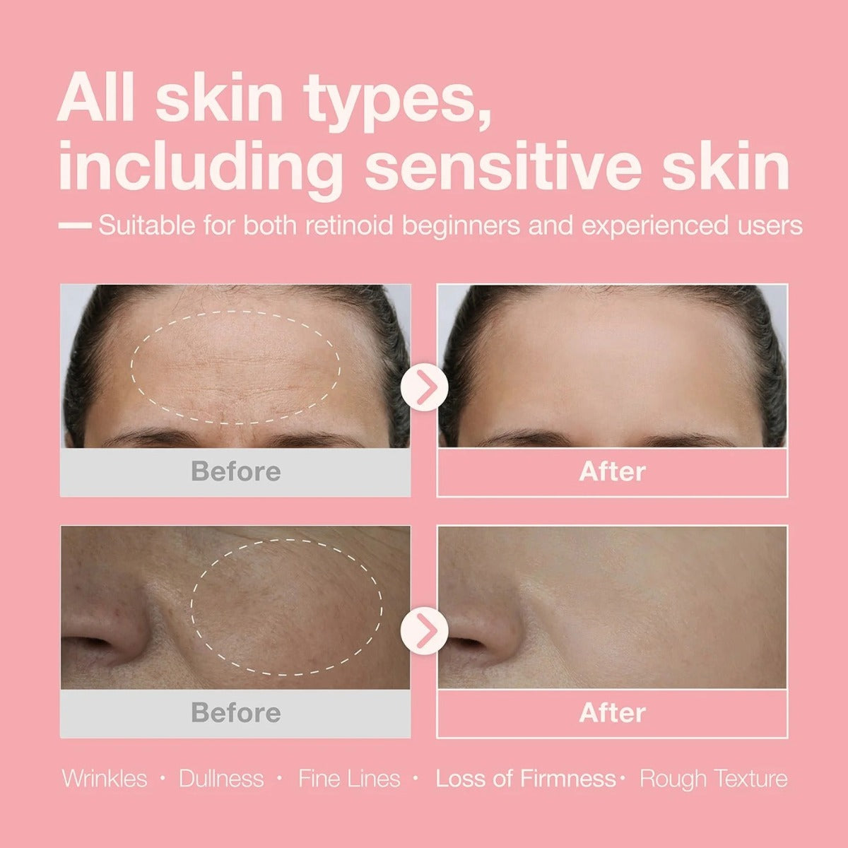 Retinol + Retinal + Peptide Booster Serum