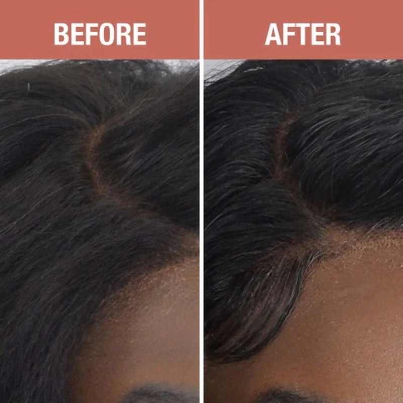 Before and after closeup of lace front hairline blending using glueless lace wig melt spray by EBIN