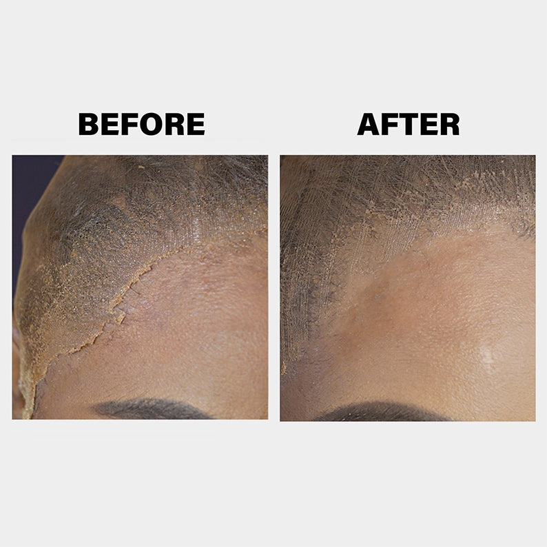 EBIN before and after close up showing smooth natural hairline using lace melt spray for wigs to blend lace