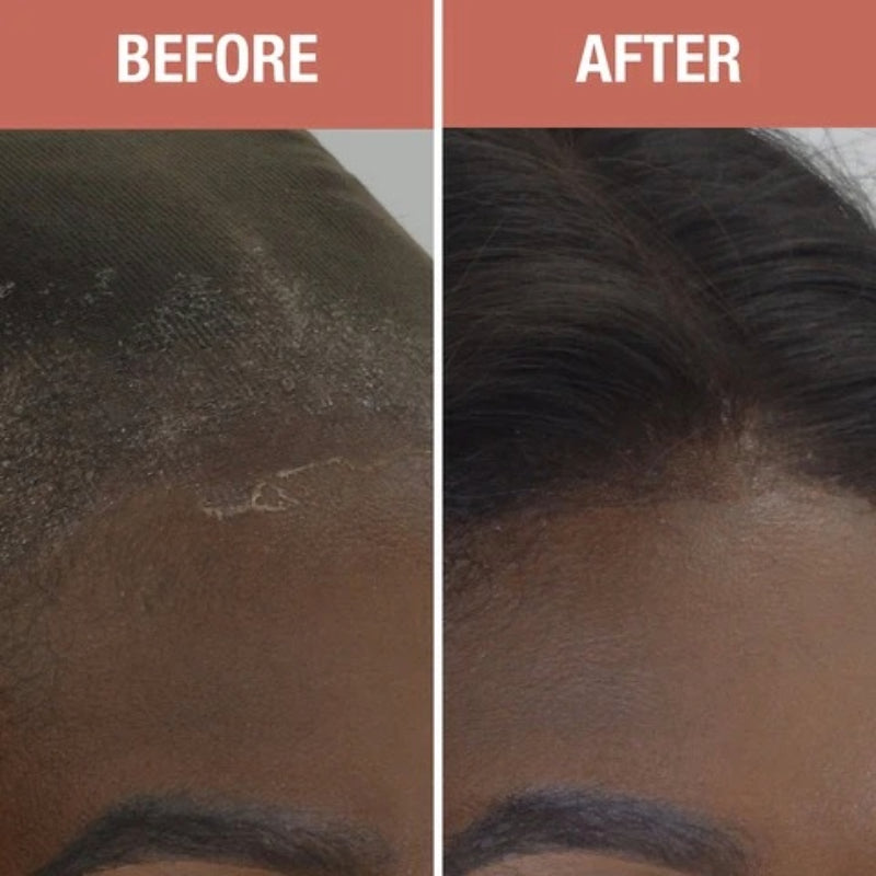 EBIN wonder lace bond adhesive spray before and after showing removal of lace glue residue